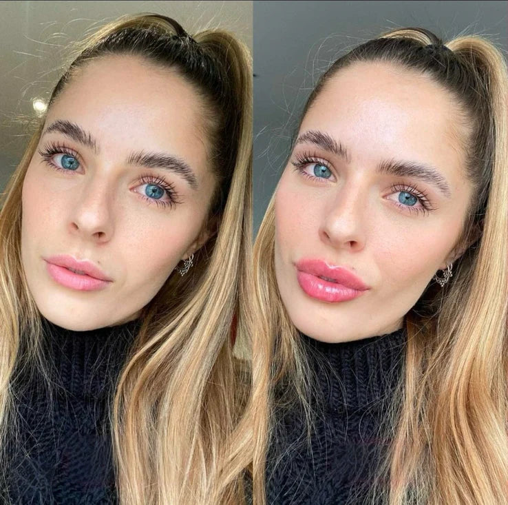 slider image slider_item_R6UJBm