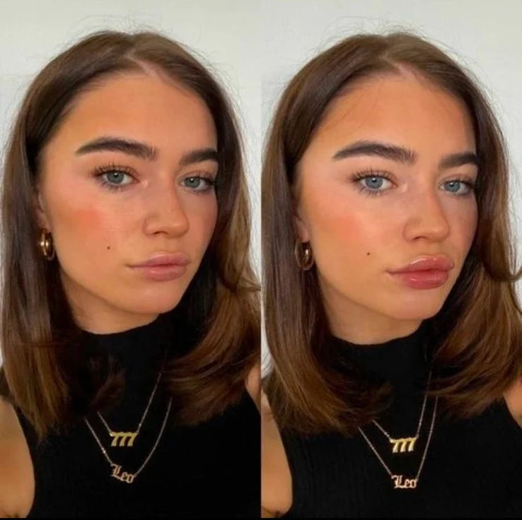 slider image slider_item_MLpaeQ