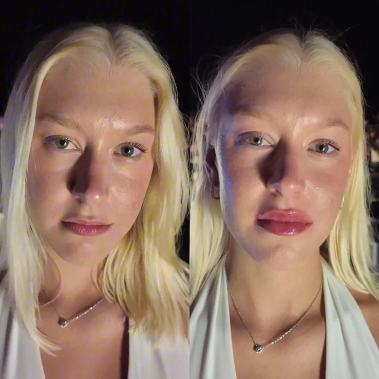 slider image slider_item_YY9pt4